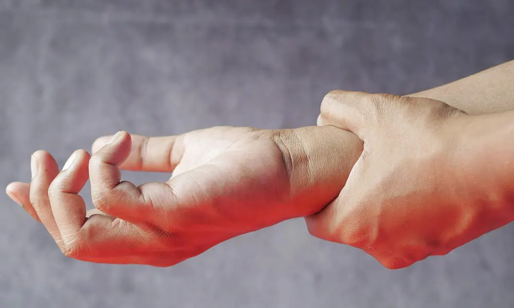 Living with Complex Regional Pain Syndrome